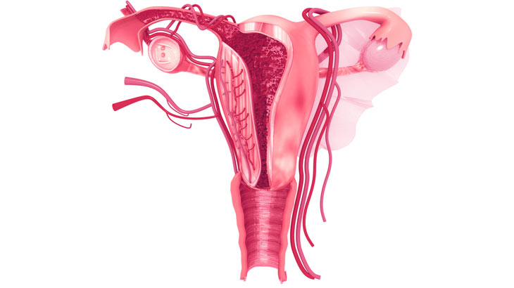 Diagnosing and Treating Asherman’s Syndrome