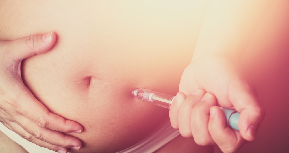 What is Ovarian Hyperstimulation Syndrome (OHSS), and how can I prevent it?