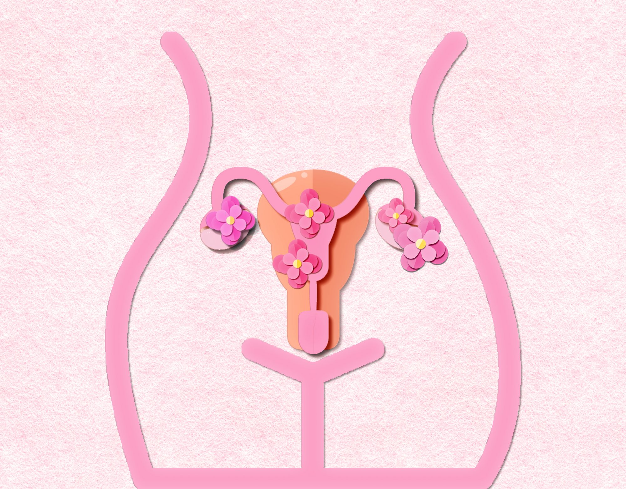 4 Things to Know About PCOS and Fertility